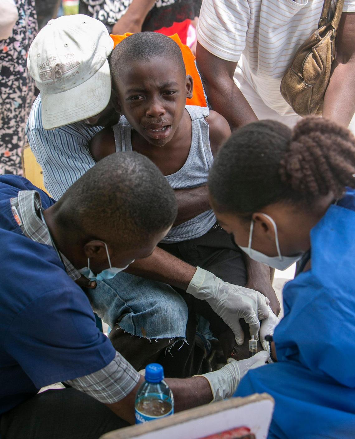 Marceline, Haiti, August 18, 2021 - Timothee Jean-Jacques (lower left) and Rose-Milord Celestin (lower right) take care of a childs wound at the tent they set up on an empty field near a collapsed school in Marceline. Doctors Timothee Jean-Jacques, Wonston Raphael, Ruben Misaac Pierre, Stanley Ettenne, Medgina Felix and Physical Therapist Rose-Milord Celestin, used their own money to buy medicals supplies and transported themselves and the supplies to Marceline to help out the victims of the earthquake.