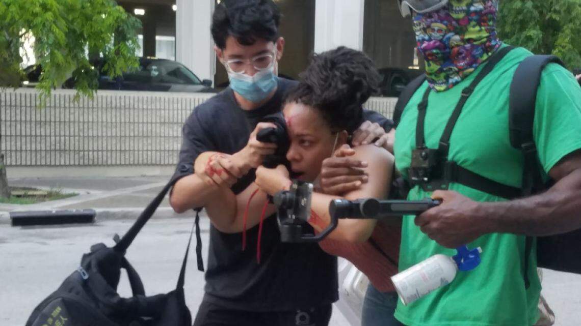 After a police officer shot LaToya Ratlieff in the face with a foam rubber bullet as she stumbled away from tear gas, other protesters rushed to the aid of the bleeding woman. Fort Lauderdale Police Department protocols say officers should only aim for the head and neck if they intend to use “deadly force.”