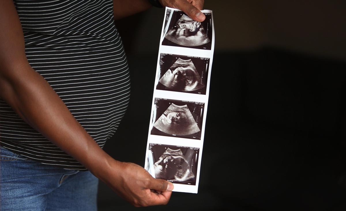 Alena Costume holds images from an ultrasound taken of their baby girl, Remy. Alena had to attend appointments with her obstetrician by herself the last few months of her pregnancy due to restrictions caused by the coronavirus pandemic.