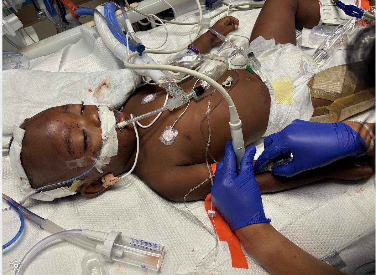 Two-year-old Deagoo Henry’s skull was fractured during the shooting, and he was placed in a medically induced coma. He is now awake and responsive.