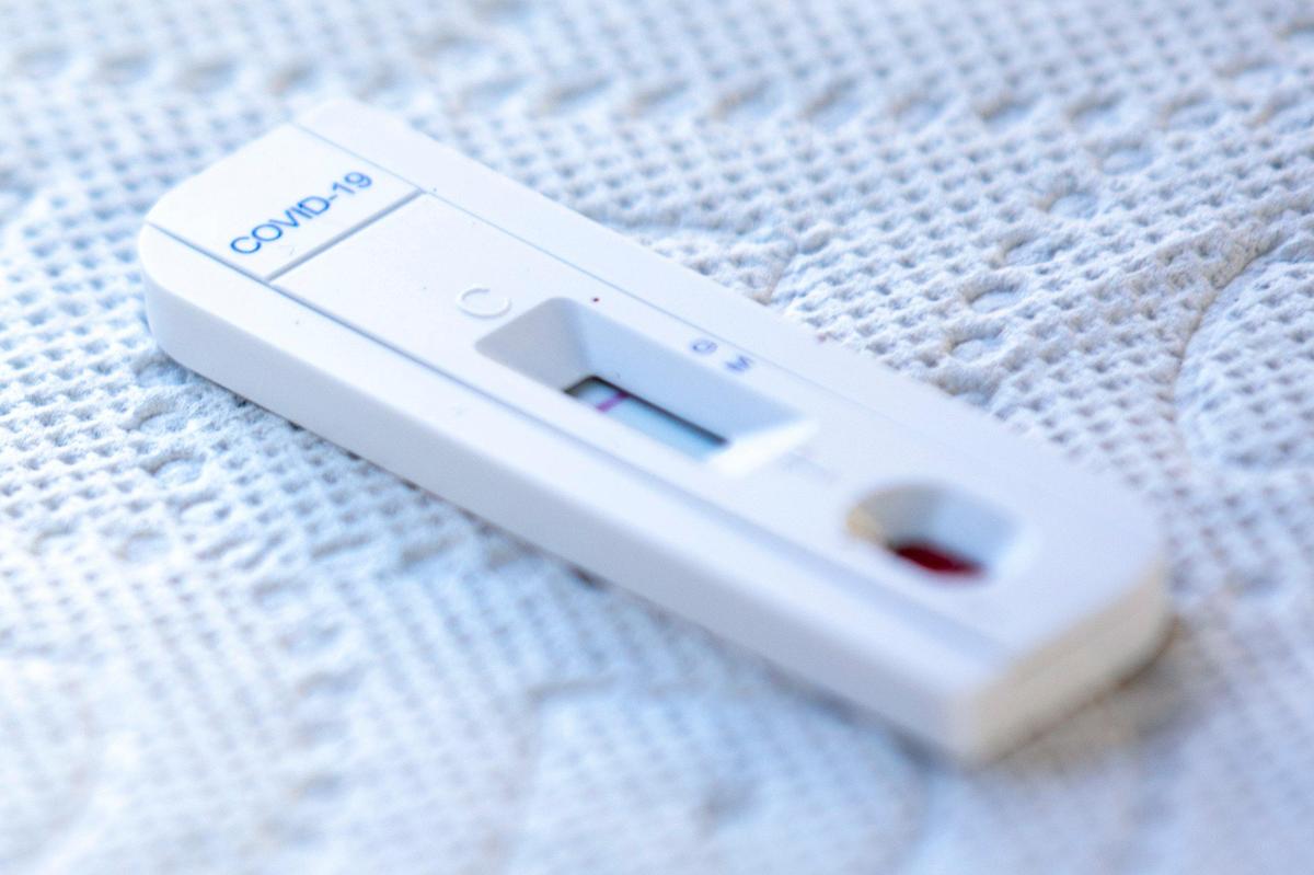 A coalition of volunteers led by University of Miami doctor Armen Henderson have started using a rapid antibody test to see who has been exposed to COVID-19 among the homeless community.