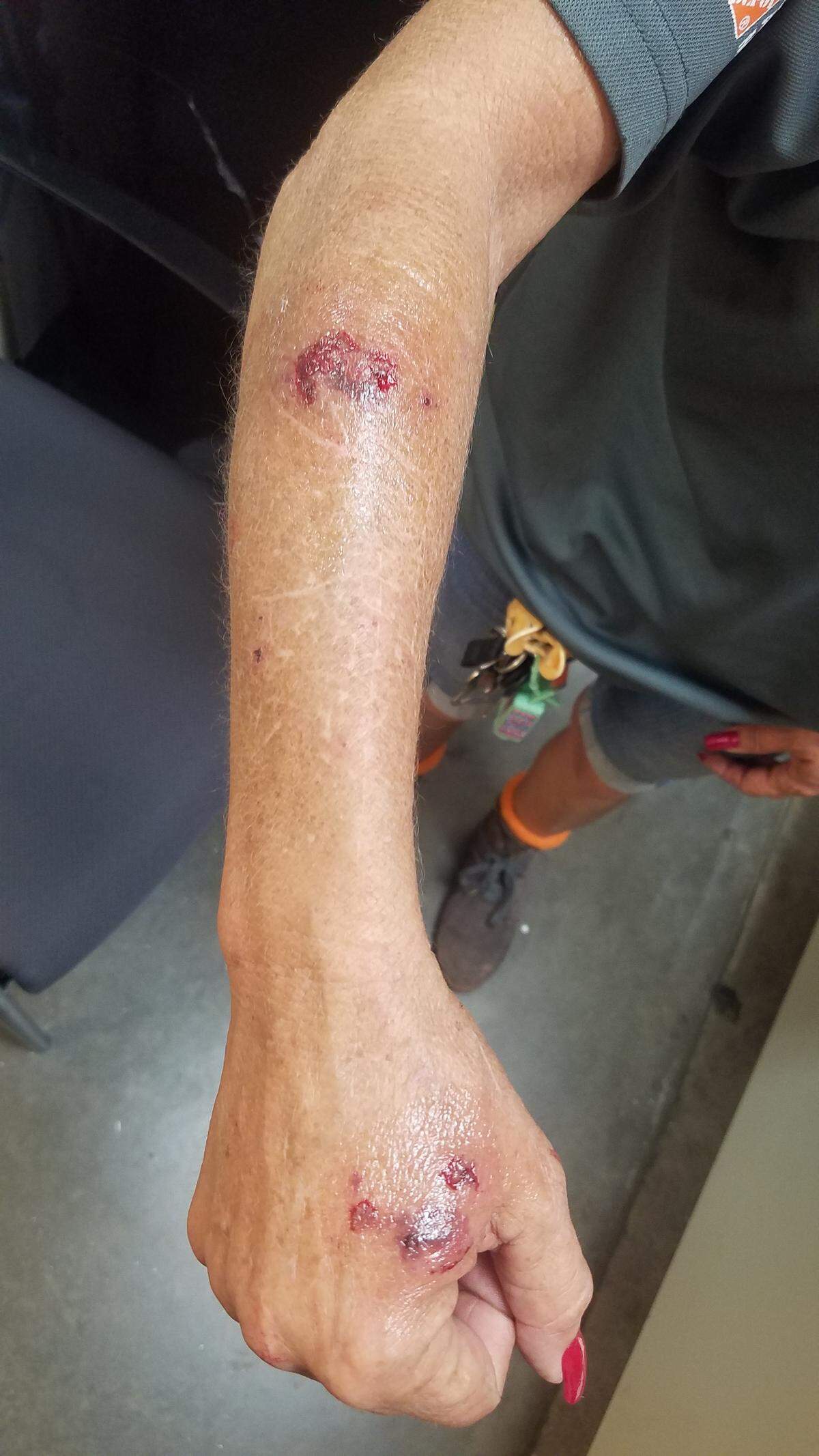 Home Depot employee Marilyn Howard was bitten on her arm by a pet spider monkey found in the parking lot of the Okeechobee store on June 4, 2018.