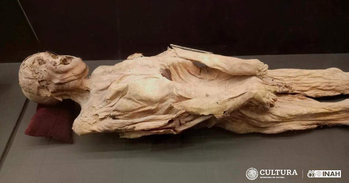A famous mummy known as “The Stabbed One” was found to have a detached arm, officials said.