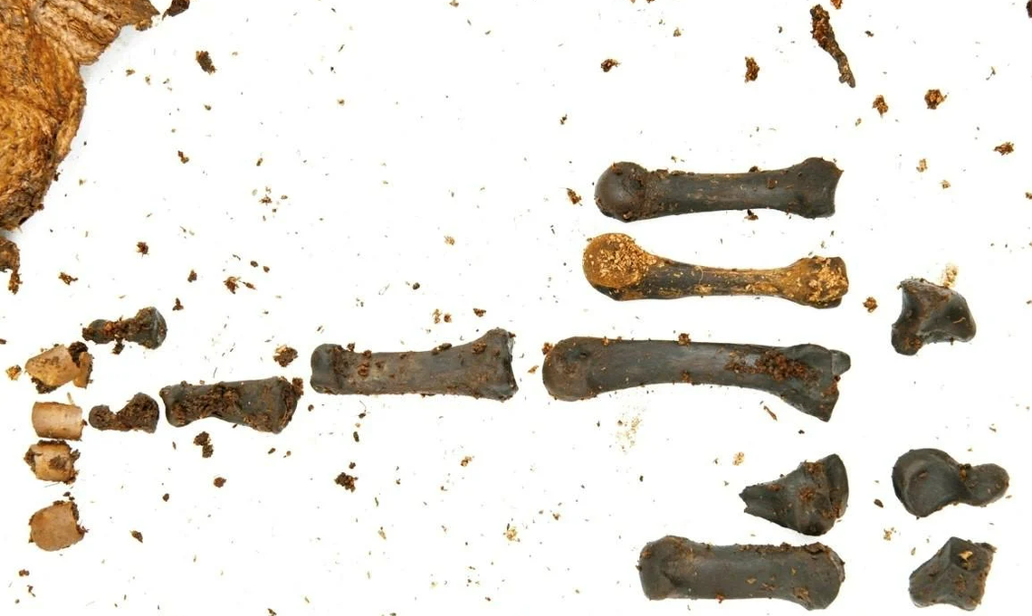 Left hand bones belonging to the ancient teenage boy were unearthed, police said.