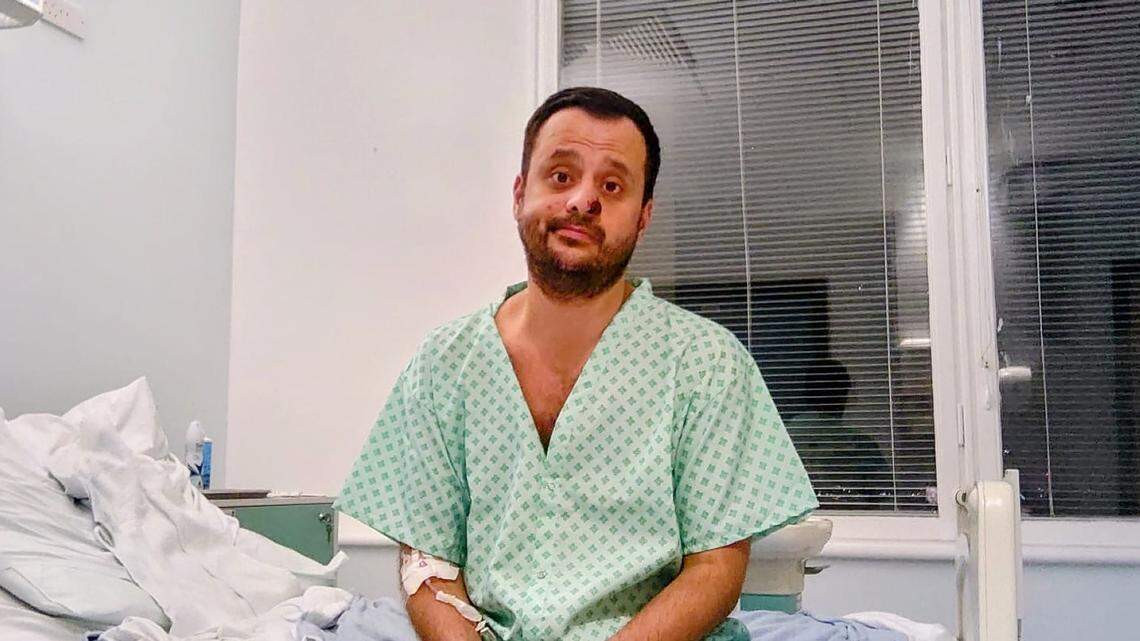 Harun Tulunay, of London, is seen in the hospital with a large lesion on his nose due to a monkeypox infection.