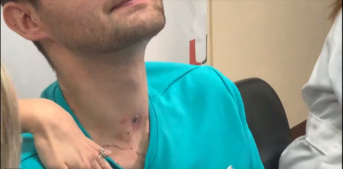 On Thursday, Nick Williams still had marks from the chain that melted on his skin the day he was struck by lightning. The imprint of the cross has already faded, according to his fiancée.
