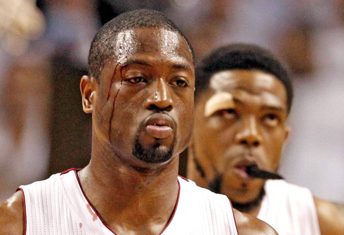 Miami Heat’s Dwyane Wade walks off the court after a flagrant foul in the second quarter by the Indiana Pacers’ in Round 2, Game 5 of the NBA Playoffs at the AmericanAirlines Arena in Miami, Florida, May 22, 2012. Udonis Haslem in the background with his wound.