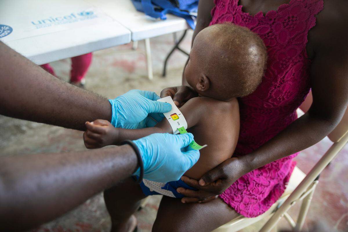 A healthcare worker measures the upper arm circumference of Chrisle Amboise 2, at a malnutrition clinic run by UNICEF, in Cité Soleil, Haiti, Sunday, Oct. 16, 2022.
