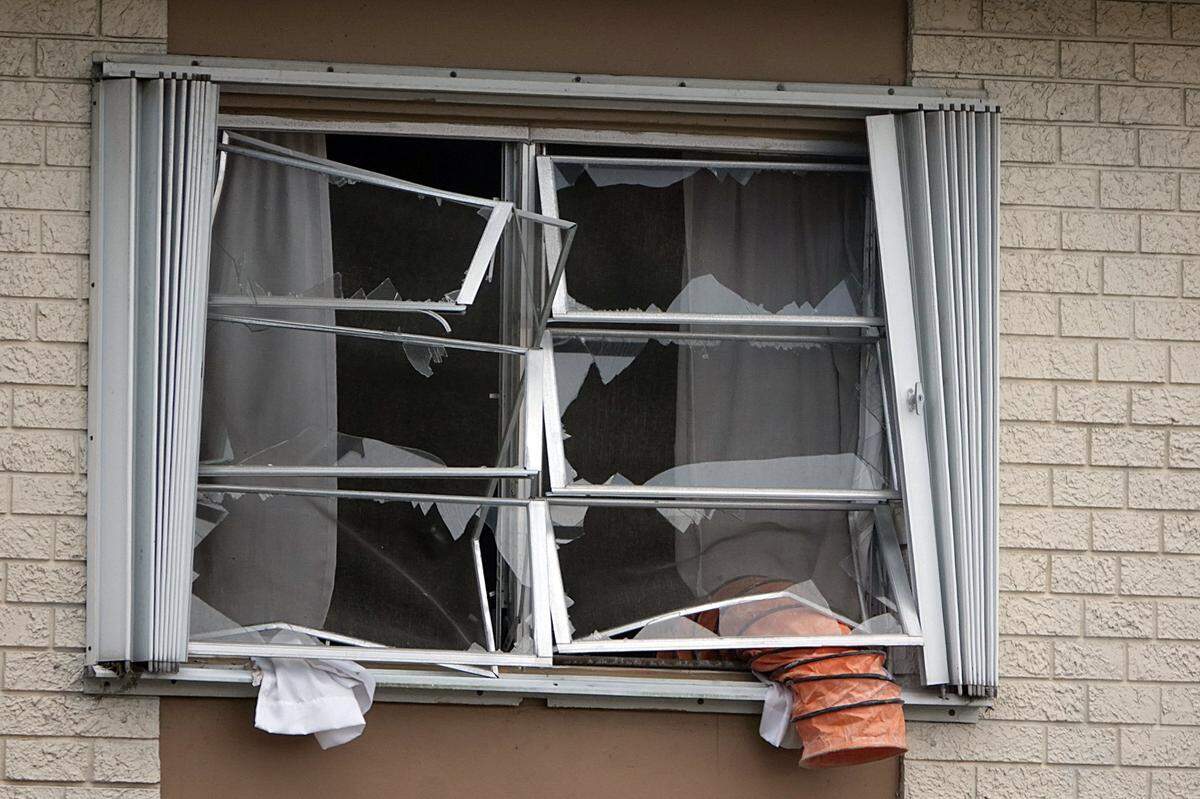 One man was hospitalized in serious, but stable condition on Tuesday, March 1, 2022, after an explosion and fire in the bathroom of his Wilton Manors apartment.