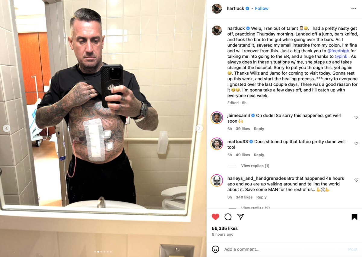 Carey Hart reveals scary injuries that led to an apology to his wife.