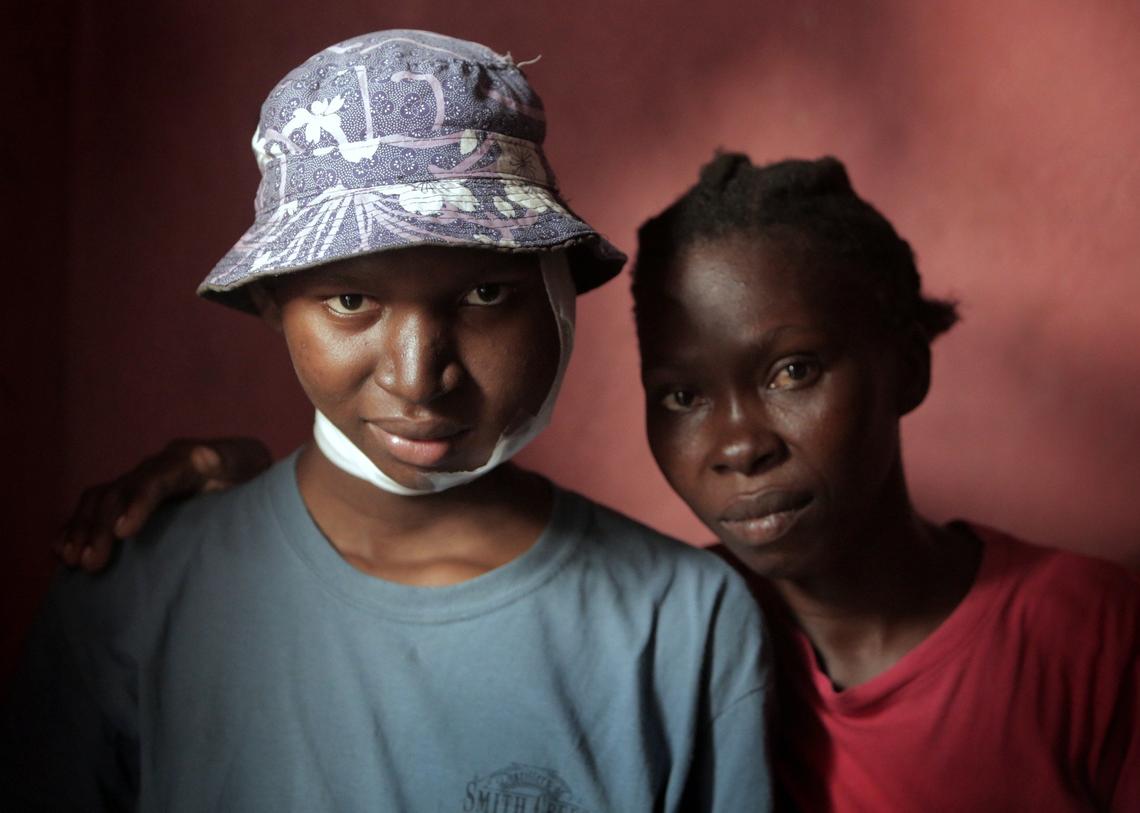 Angena Altidor went to at least five different doctors and dentists to find out why her 17-year-old son, Djooly Jeune, was growing a tumor on his face. She finally got her answer earlier this year: Burkitt’s lymphoma.