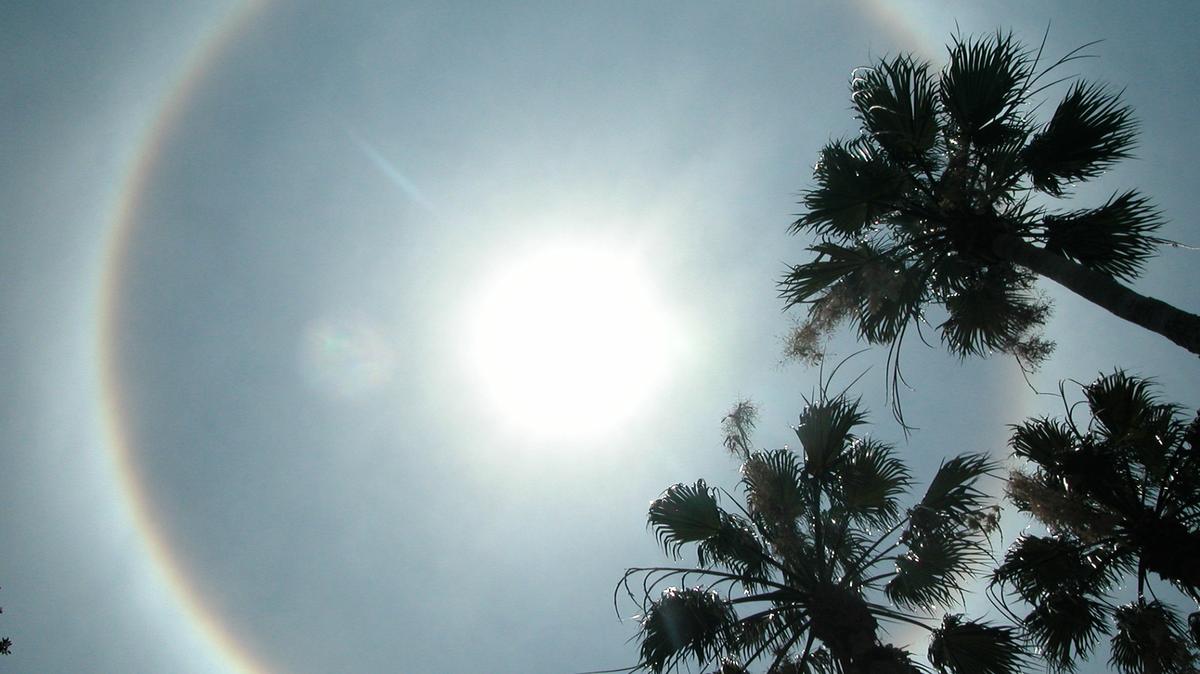 Tinted sunscreens can help protect against the sun’s UV rays and should be worn if you are getting treated for melasma.