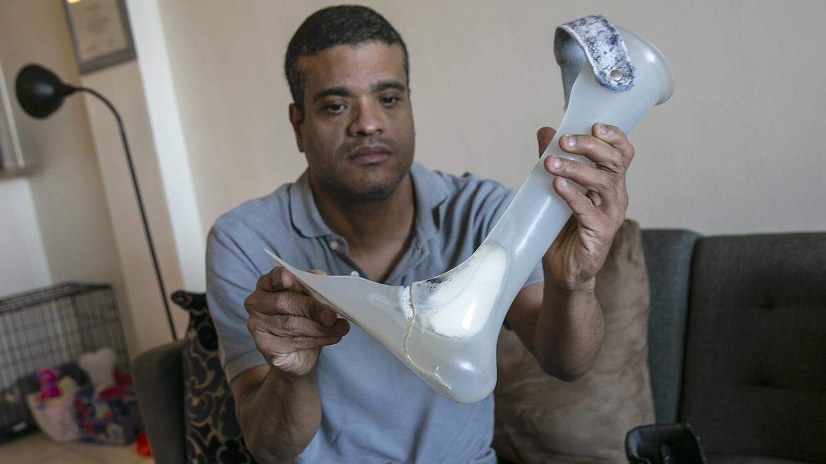Rolando Ramírez muestra uno de sus  ‘leg braces” rotos que necesita reemplazar.