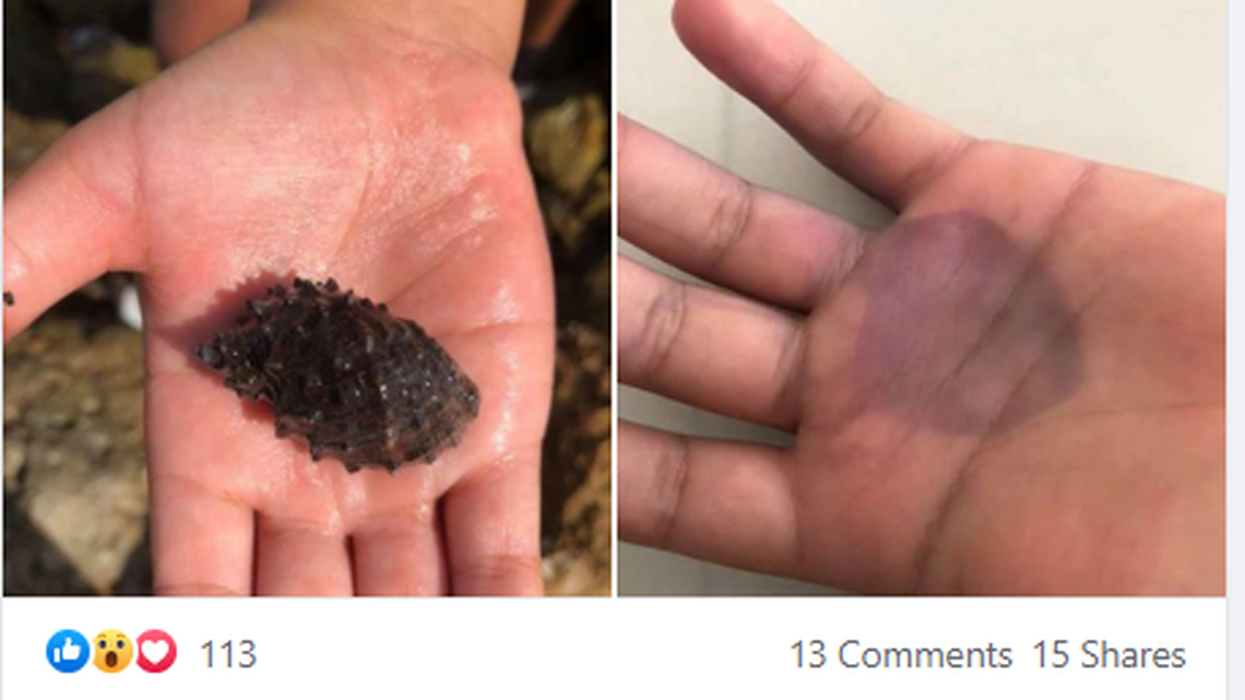 Beware the “white mucus” secreted by these marine snail. It can turn your skin blue-purple.