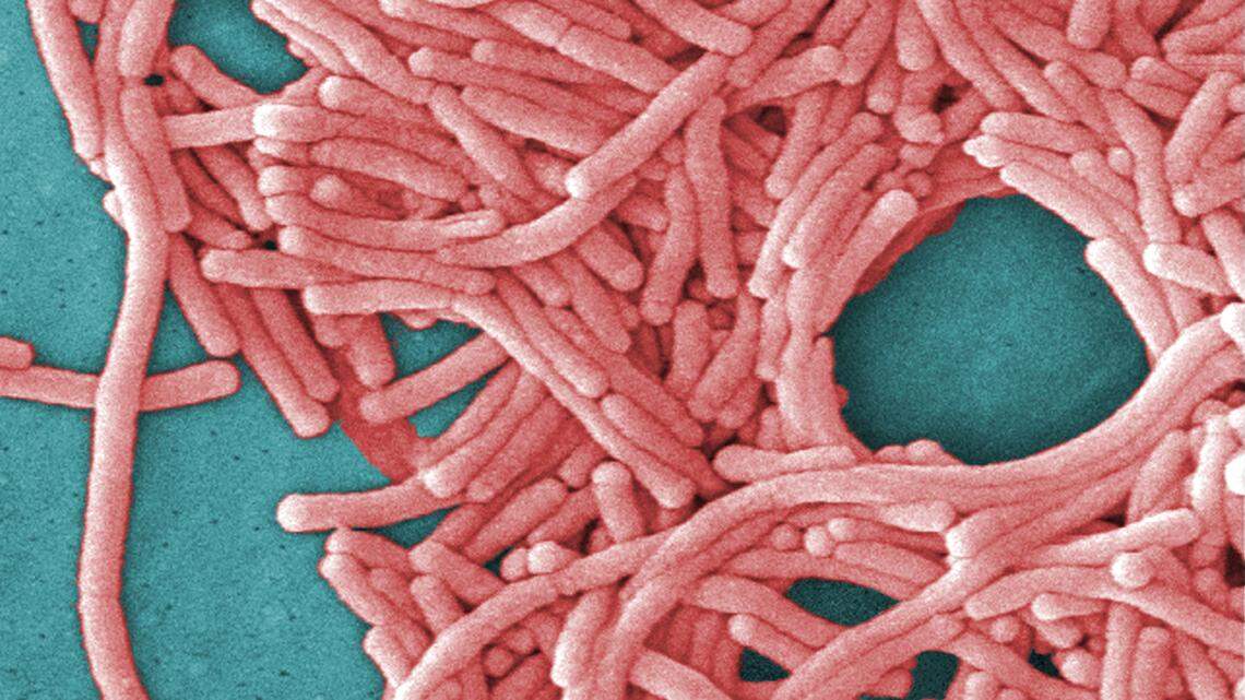 This undated image made available by the Centers for Disease Control and Prevention shows a large grouping of Legionella pneumophila bacteria (Legionnaires’ disease).