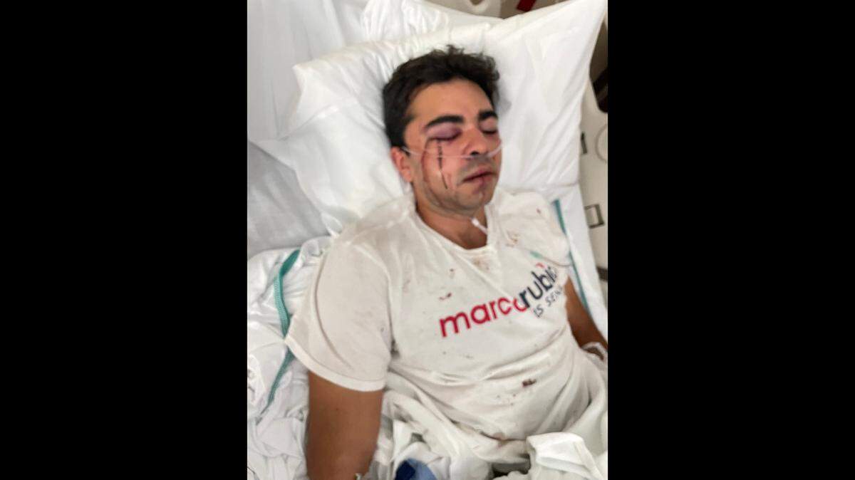 Un hombre con una camiseta de la campaña del senador Marco Rubio fue atacado el domingo 23 de octubre de 2022 en Hialeah, según el senador federal Marco Rubio.
