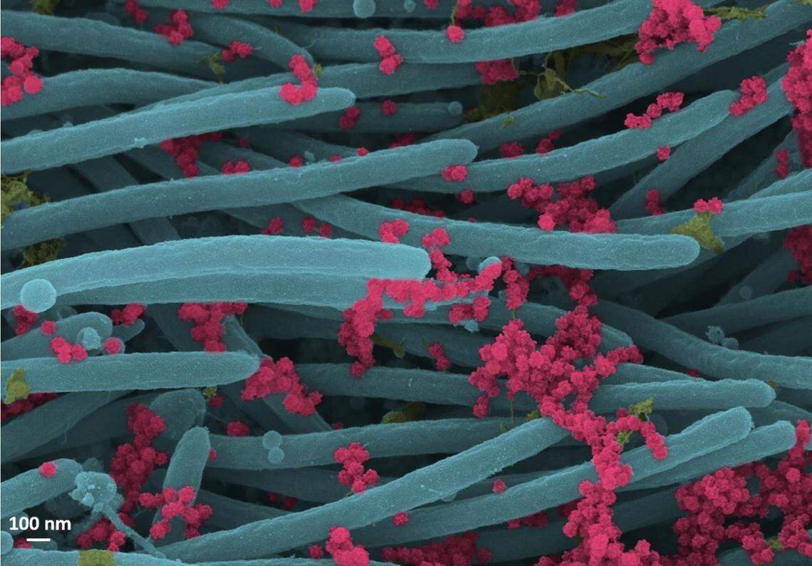 SARS-CoV-2 virions (red).