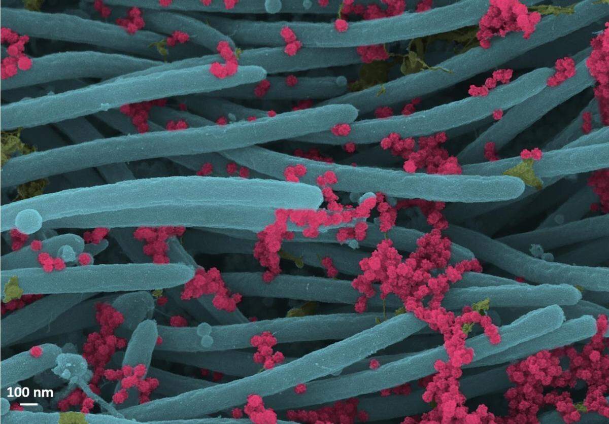 SARS-CoV-2 virions (red).