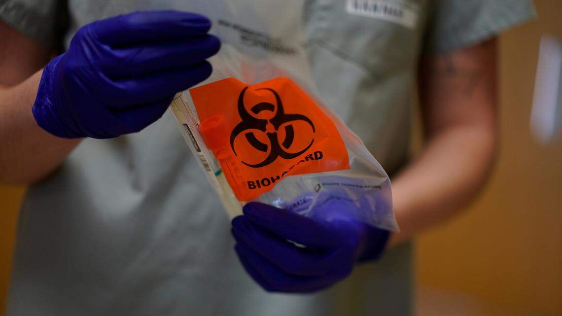 Coronavirus weekly need-to-know: odds of getting long COVID, lying about virus & more