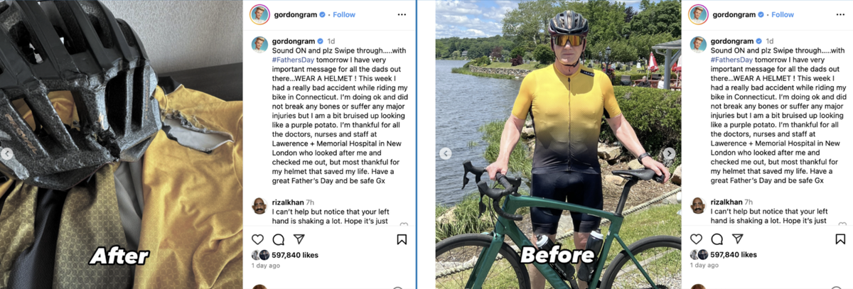 Chef Gordon Ramsay is revealing the horrific injury he suffered after getting into a bad bike accident.