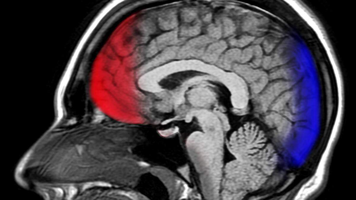 A study published in the journal Psychological Science says that the brains of procrastinators have a larger amygdala, which deals with emotions, and less connection with the dorsal anterior cingulate cortex.
