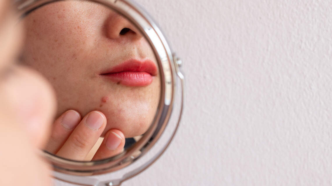 Why Dermatologists Say the Fix for Reactive Skin Is Backing Off, Not Buying More