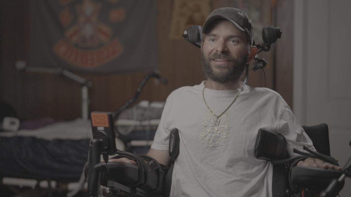 Elon Musk’s brain chip was put in a patient at Miami-area hospital. What to know