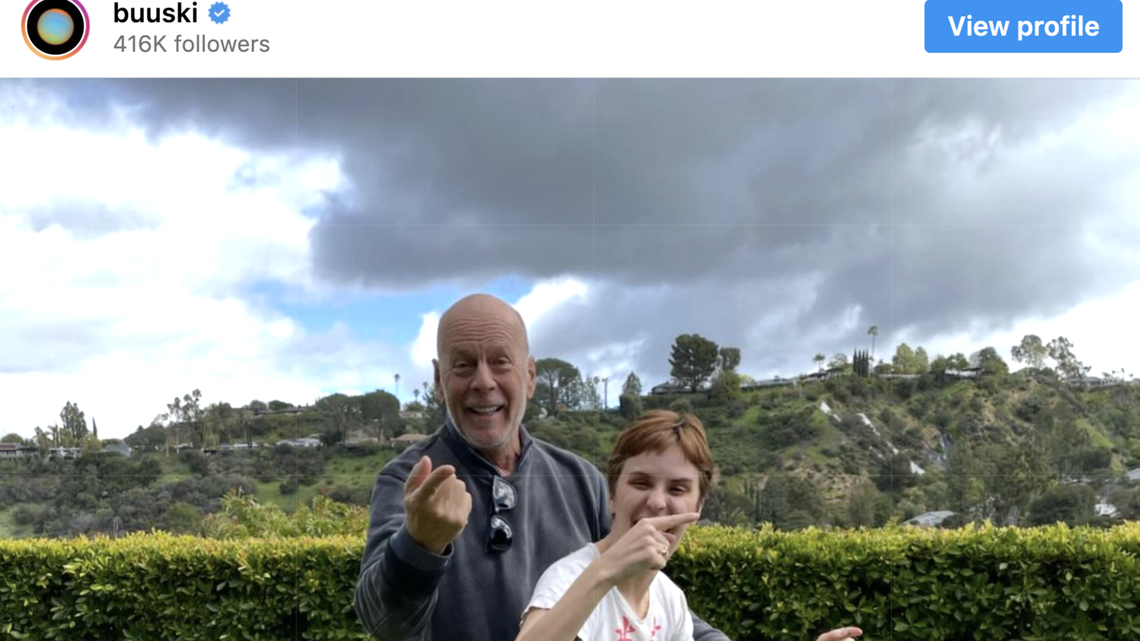 In 2023, Willis was diagnosed with frontotemporal dementia, or FTD. As a result, the actor was forced into retirement.