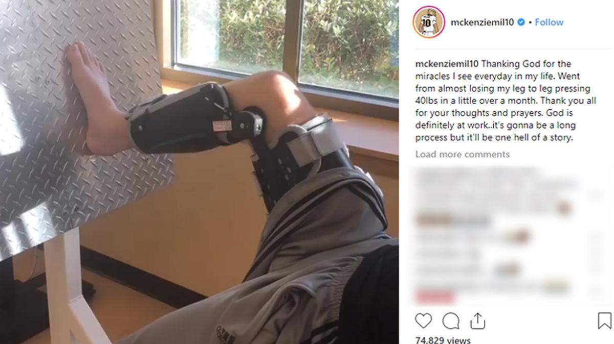 UCF quarterback McKenzie Milton posted a video of him doing 40-pound leg presses less than two months after a serious knee injury against USF resulted in multiple knee surgeries.