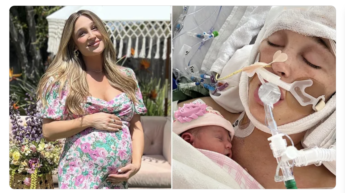 Influencer Jackie Miller James is speaking out for the first time after suffering a brain aneurysm while 39 weeks pregnant.