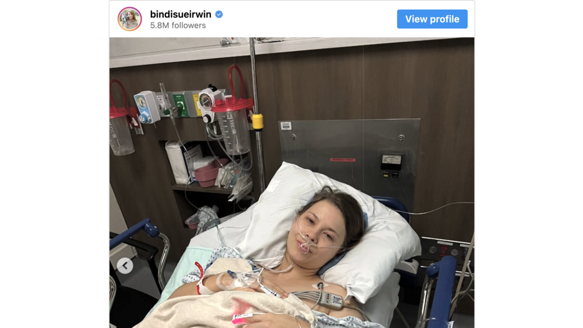 Robert Irwin praises Bindi Irwin after she shares update after emergency surgery