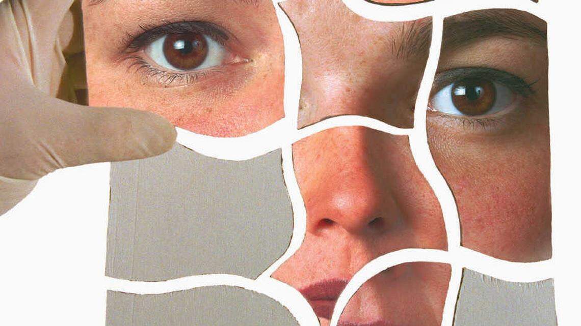 There’s new tech for nose jobs — but nothing can replace the human touch