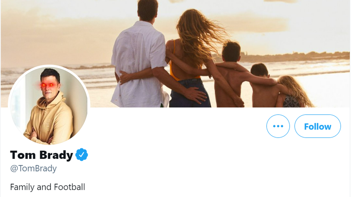 Tom Brady changes profile photo to Bitcoin laser eyes. And Twitter reacted