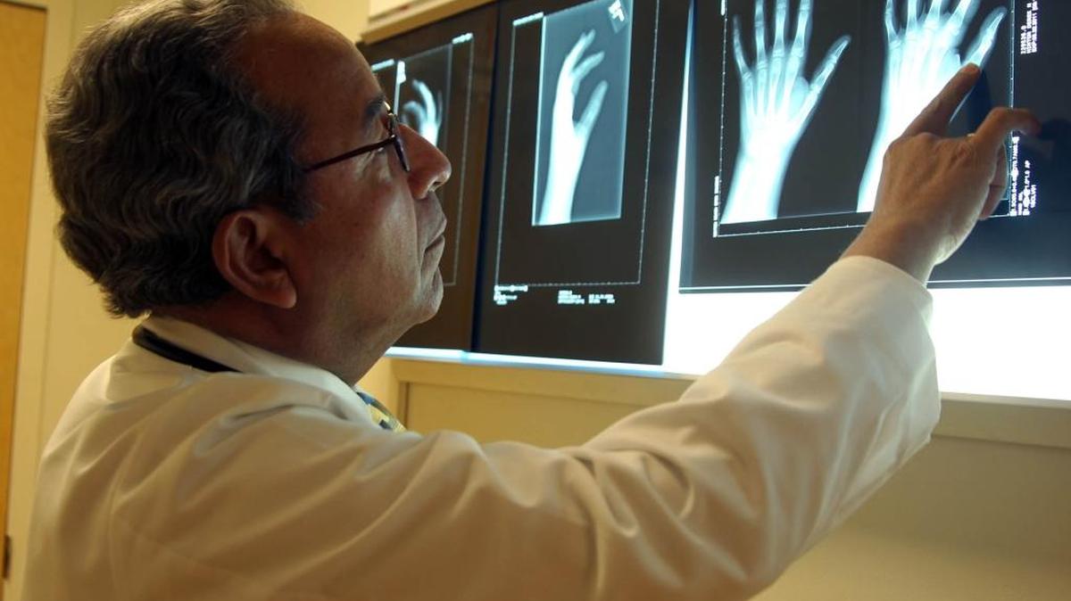 Dr. Rafael Rivas Chacon, director of the division of rheumatology at Nicklaus Children’s Hospital, reviews an X-ray of a child’s hands to determine the extent of arthritis.