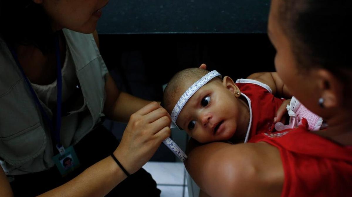 Dr. Megumi Itoh, left, an epidemic intelligence officer with the U.S. Centers for Disease Control and Prevention (CDC), measures the head of 5-month-old Adrielly Rufino, as she is held by her mother, Maria Girdielly, 17, as part of the CDC and Brazil's Ministry of Health case-control study investigating the association between women having the Zika virus when they are pregnant, and the effects they are seeing of microcephaly in babies.