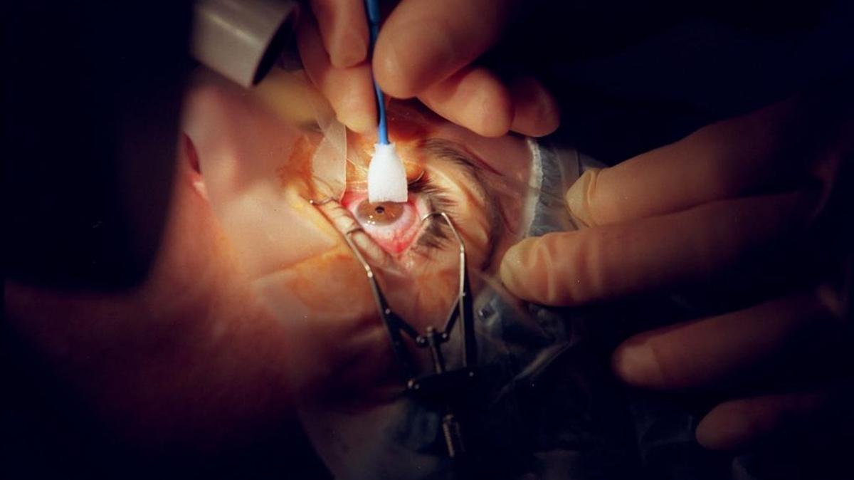 Dr. William Culbertson performs LASIK surgery at Bascom Palmer Eye Institute at the University of Miami.