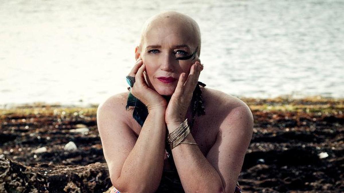 
A DRAMATIC LOOK: Cancer survivor Lori Cuellar of Miami.
