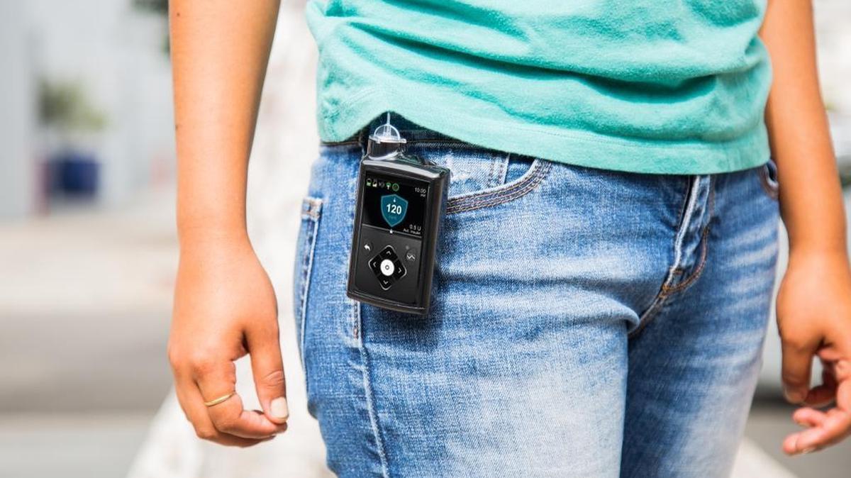 The Medtronic MiniMed 670G, which the FDA recently approved for type 1 diabetics ages 14 and older. It’s due to go on the market in the spring; it monitors glucose levels and administers insulin automatically.