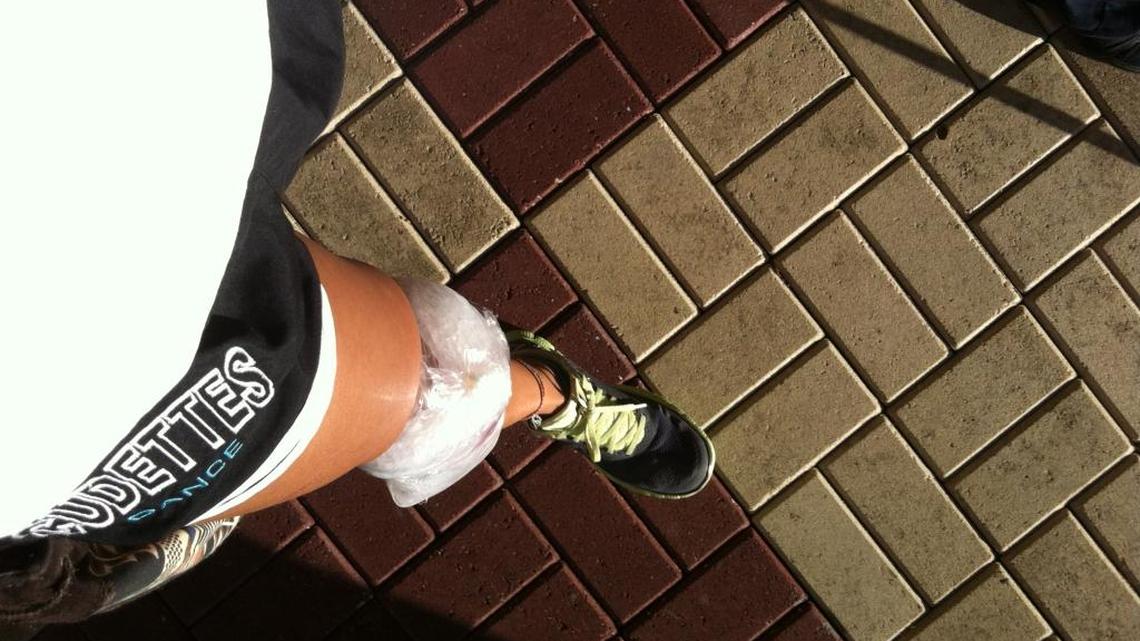 A swollen knee can be caused when your knee is hit and the thin sac around the kneecap, known as the bursa, swells.