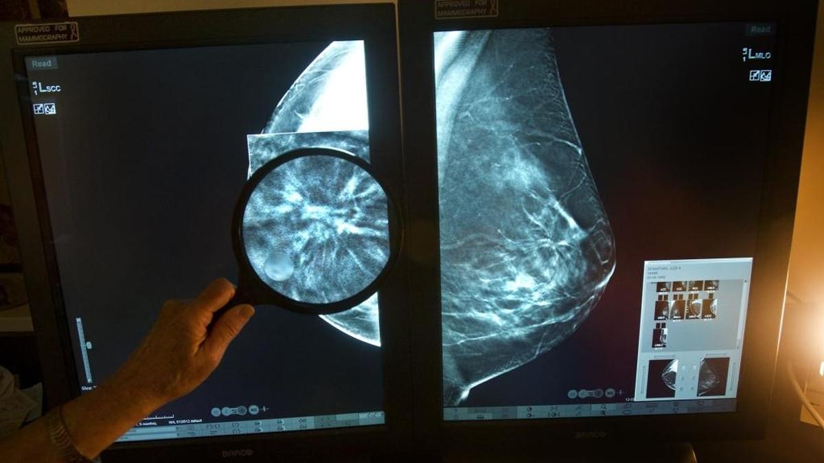 Dr. Nilza Kallos, a South Miami radiologist, reads an image from a new machine that produces 3D mammograms that make it easier for doctors to find cancerous tumors at an early stage on Tuesday April 30, 2013.