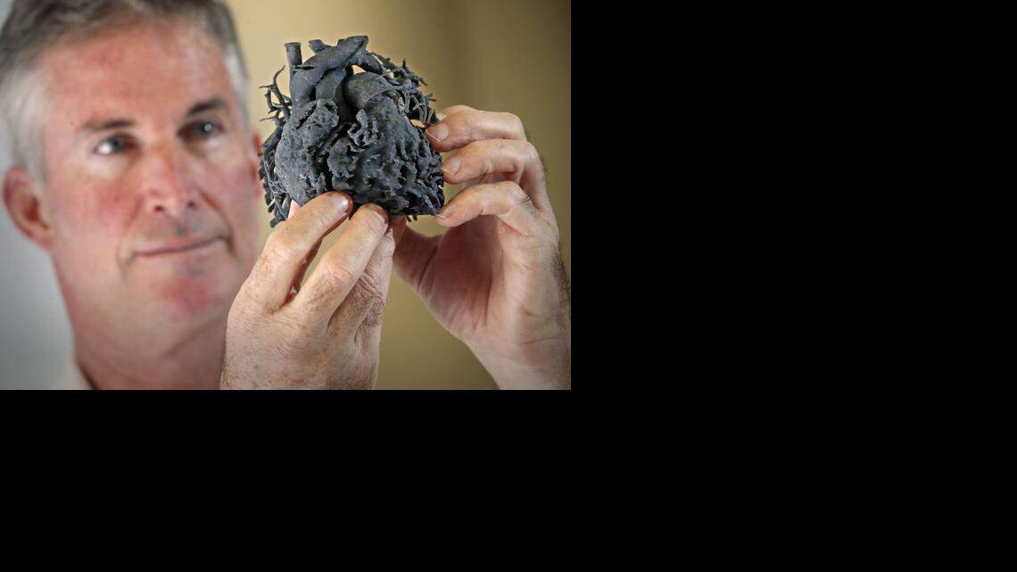 
Dr. Redmond P. Burke, chief of cardiovascular surgery at Miami Children’s Hospital, holds a 3D-printed heart model. The program is the first in the region to use 3D printing technology to create a model of a patient's heart to plan the surgery for a child born with a heart anomaly. 
