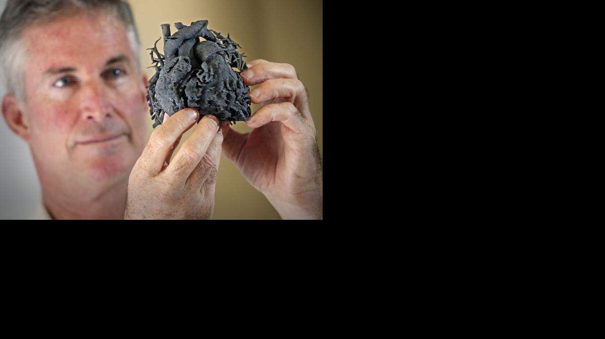 
Dr. Redmond P. Burke, chief of cardiovascular surgery at Miami Children’s Hospital, holds a 3D-printed heart model. The program is the first in the region to use 3D printing technology to create a model of a patient's heart to plan the surgery for a child born with a heart anomaly. 
