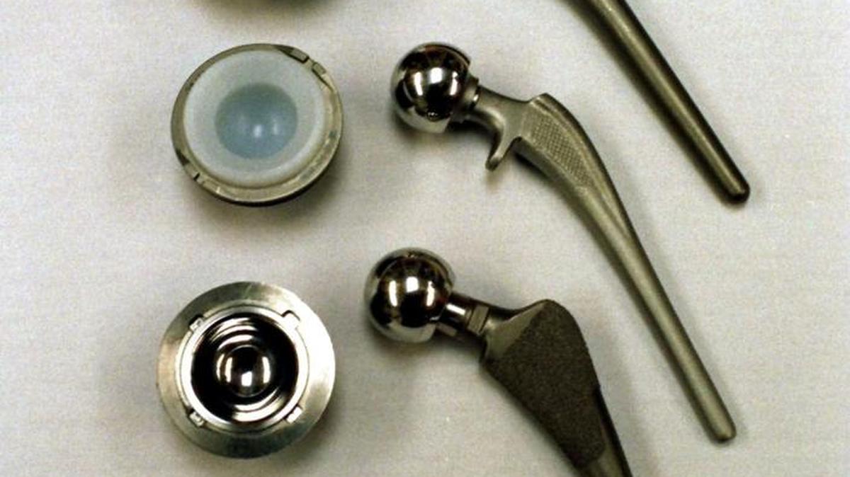 Advances in hip implants promise longer wear, perhaps decades, meaning people may not have to undergo the surgery a second time. From top are implants using ceramics, plastic and metal.