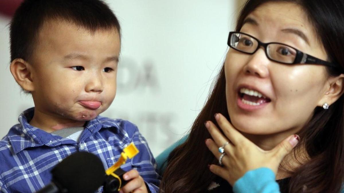 It's National Burn Awareness Week, Feb. 1-7, and Kendall Regional Medical Center’s burn center wants to educate and prevent burn injuries to both children and adults. Liping Si (right), shown with her 3-year-old son Vincent Zou, talks about the kitchen accident that burned the boy’s face, neck and chest.