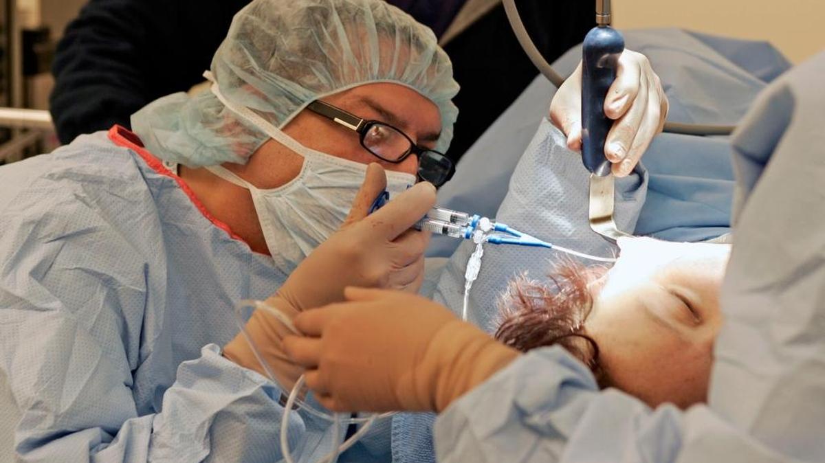 String face-lifts, while popular, don’t get the same long-lasting results as surgical face-lifts.