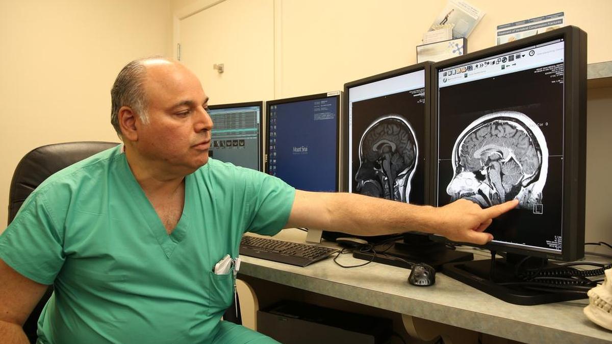 
Dr. Allen Kantrowitz, chief of the division of neurology at Mount Sinai Medical Center, demonstrates Chiari malformation type 1, at the junction of the brain and cervical spine.
