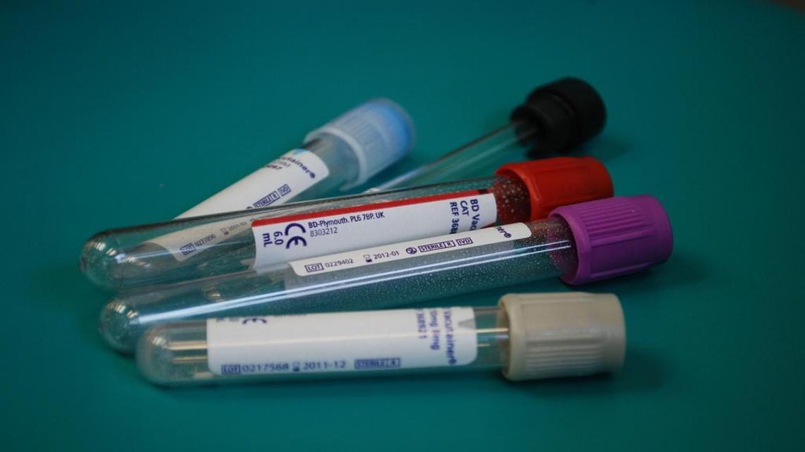 80 percent of the 3.5 million Americans with hepatitis C are boomers, but only 13.8 percent have gotten tested for the contagious liver disease that can liad to cancer and cirrhosis.