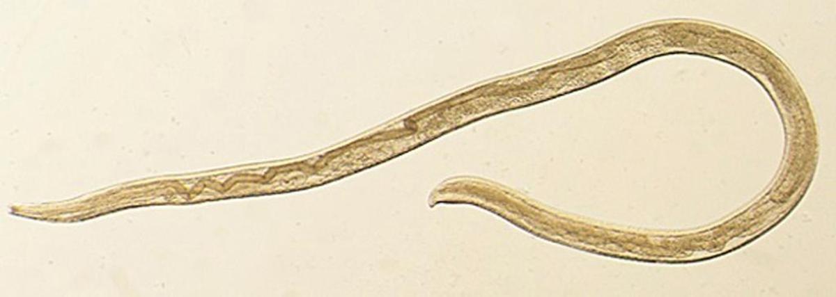 This undated photo provided by the Centers for Disease Control and Prevention (CDC) shows Thelazia gulosa, a type of eye worm seen in cattle in the northern United States and southern Canada, but never before in humans. until an Oregon woman had worms coming out of her eye in 2016. Scientists reported the case Monday, Feb. 12, 2018.