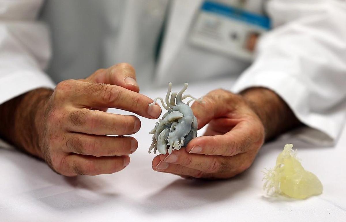 Dr. Redmond P. Burke explains the surgery he performed on baby Calvin Taylor as he holds a model he made of Calvin's heart prior to surgery, at a news conference on Thursday, Aug. 10, 2017. Calvin received life-saving heart surgery by Burke, after being deemed inoperable by four high-risk congenital heart transfer hospitals.