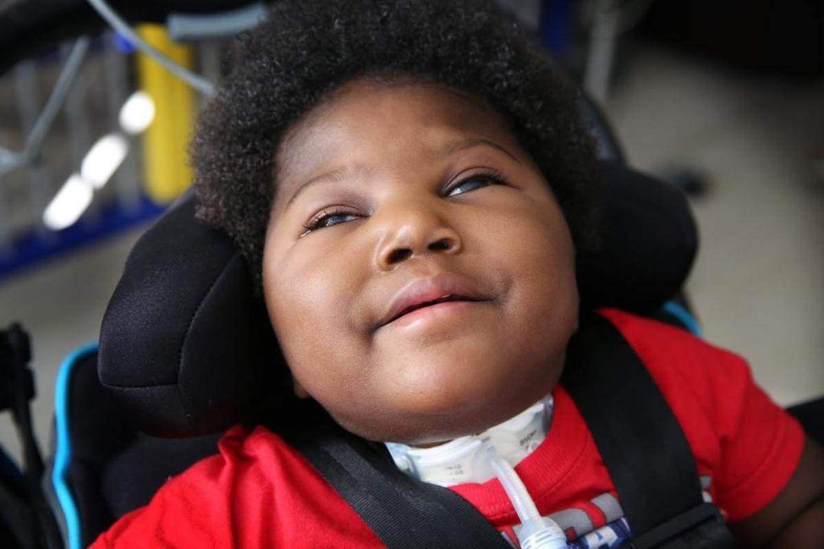 Seventeen-month-old Samuel Augustine was born with microcephaly at 25 weeks. He is gradually being weaned off a respirator he has used since birth and is nourished through a feeding tube. His mother says his long-term prognosis is uncertain, but when she sings, he often smiles.